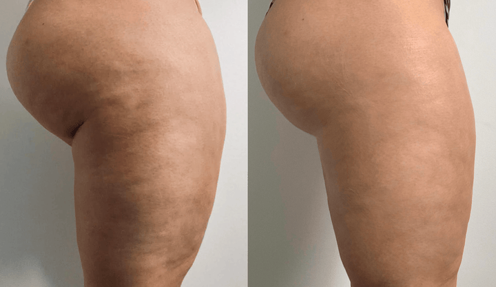 Customer before and after result 1