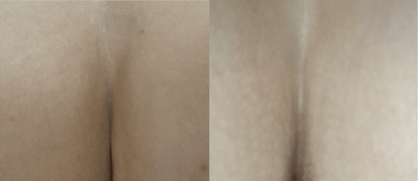Before and after results