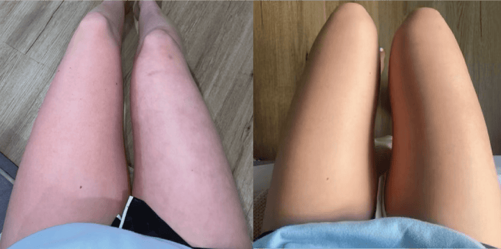 Customer before and after result 2