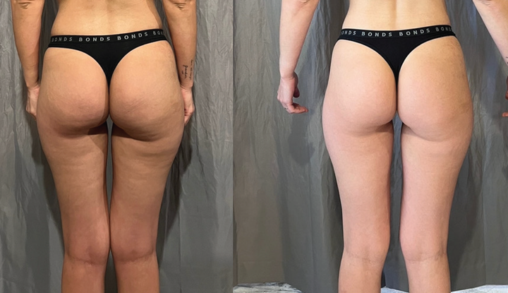 Customer before and after result 3