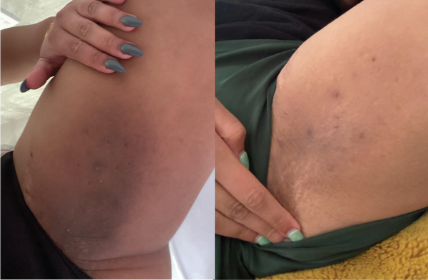 Before and after results